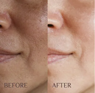 true-transformation-1