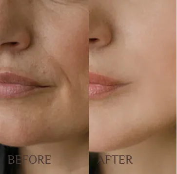 true-transformation-2